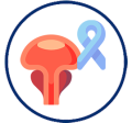 Prostate, bladder, kidney cancer